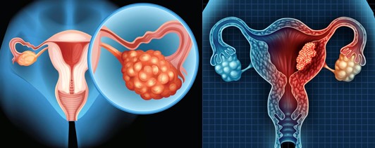 Advancements in Gynecopathology: exploring emerging entities and diagnostic innovations