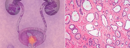 Genitourinary Pathology: Practical Diagnostic Approach