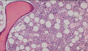 Hands-on-Hematology: Mastering Myeloid and Lymphoid Pathology
